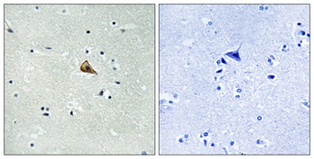 Trk A (phospho Tyr701) rabbit pAb