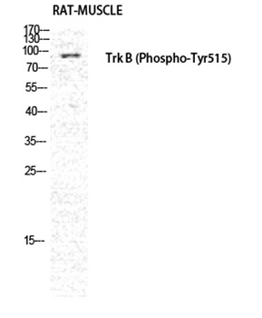 Trk B (phospho Tyr516) rabbit pAb