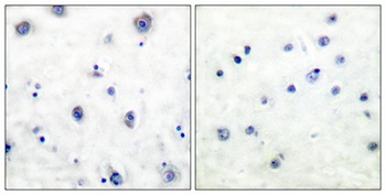 Trk B (phospho Tyr516) rabbit pAb Antibody