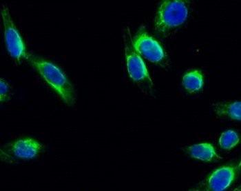 Trk B (phospho-Tyr706) antibody