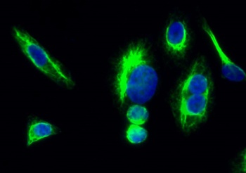 TrkB antibody