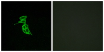 GPR143 antibody
