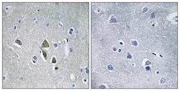 AZ1 antibody