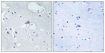 MOR-1 antibody