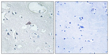 MOR-1 rabbit pAb