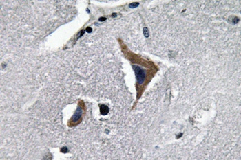 Neurophysin I antibody