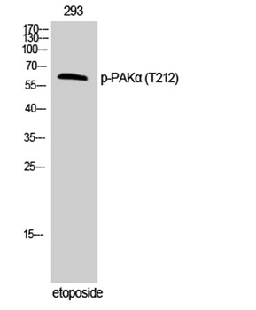 PAKα (phospho Thr212) rabbit pAb