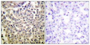 PAKα/β/γ (phospho Thr423/402/421) rabbit pAb
