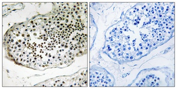 Ubiquilin-3 rabbit pAb
