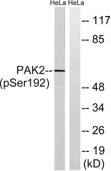 PAK gamma (phospho-Ser192) antibody