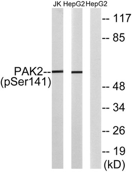 PAK gamma (phospho-Ser141) antibody