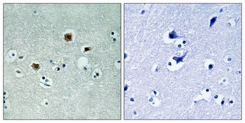 PAKβ rabbit pAb