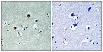 PAK beta antibody