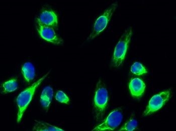 NGEP antibody