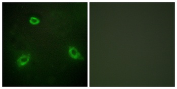 NGEP rabbit pAb Antibody