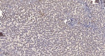 T2R1 rabbit pAb Antibody