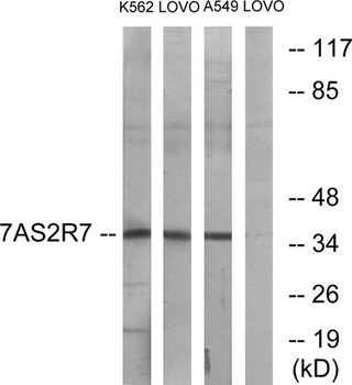 T2R7 rabbit pAb Antibody