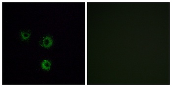 T2R14 antibody