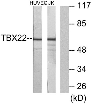 TBX22 antibody