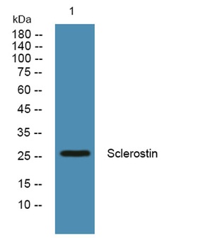 Sclerostin antibody
