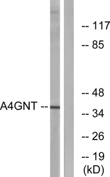 alpha4Gn-T antibody