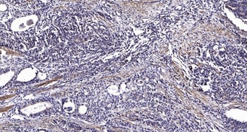 LEF-1 (phospho Ser42) rabbit pAb Antibody