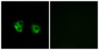 MATCH2 antibody