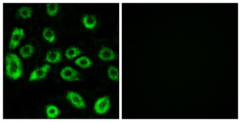 ATP5D rabbit pAb