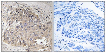 Spectrin β V rabbit pAb