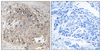 Spectrin beta V antibody