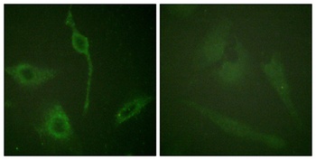 PDGFR-α rabbit pAb Antibody