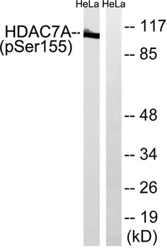 HDAC7 (phospho-Ser155) antibody