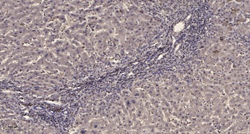 PDGFR-beta (phospho-Tyr771) antibody