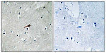 PDGFR-β (phospho Tyr740) rabbit pAb