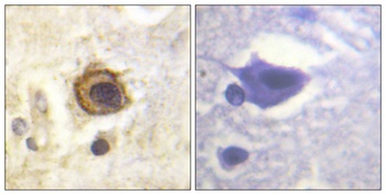 PDGFR-β rabbit pAb Antibody
