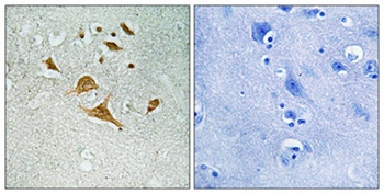 CDK5 Activator-binding C42 rabbit pAb