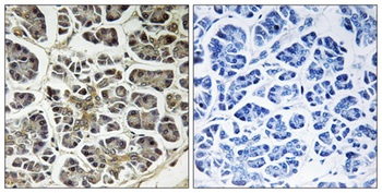 ATP5G2 rabbit pAb