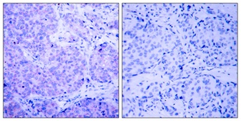 PDHK1 (phospho Ser241) rabbit pAb