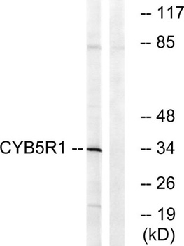CYB5R1 rabbit pAb