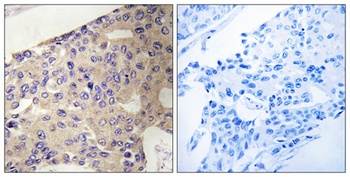 Peroxin 10 rabbit pAb