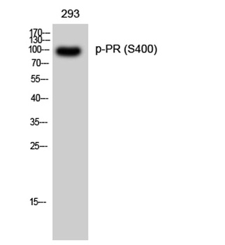 PR (phospho-Ser400) antibody