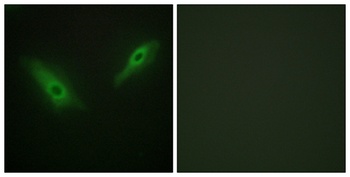 PHKA1/2 antibody