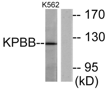 PHKB rabbit pAb