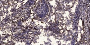 PHKB rabbit pAb Antibody
