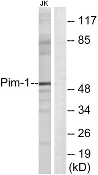 Pim-1 rabbit pAb Antibody