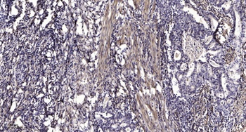 Pim-1 rabbit pAb Antibody