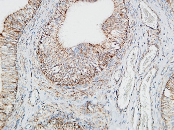 Pin1 rabbit pAb Antibody