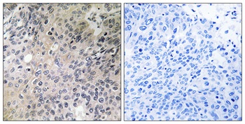 N-Shc antibody