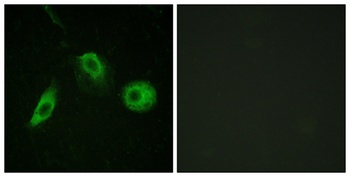 PLC γ2 (phospho Tyr1217) rabbit pAb