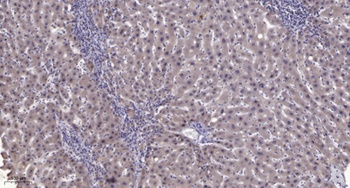 PC-PLD1 (phospho-Thr147) antibody